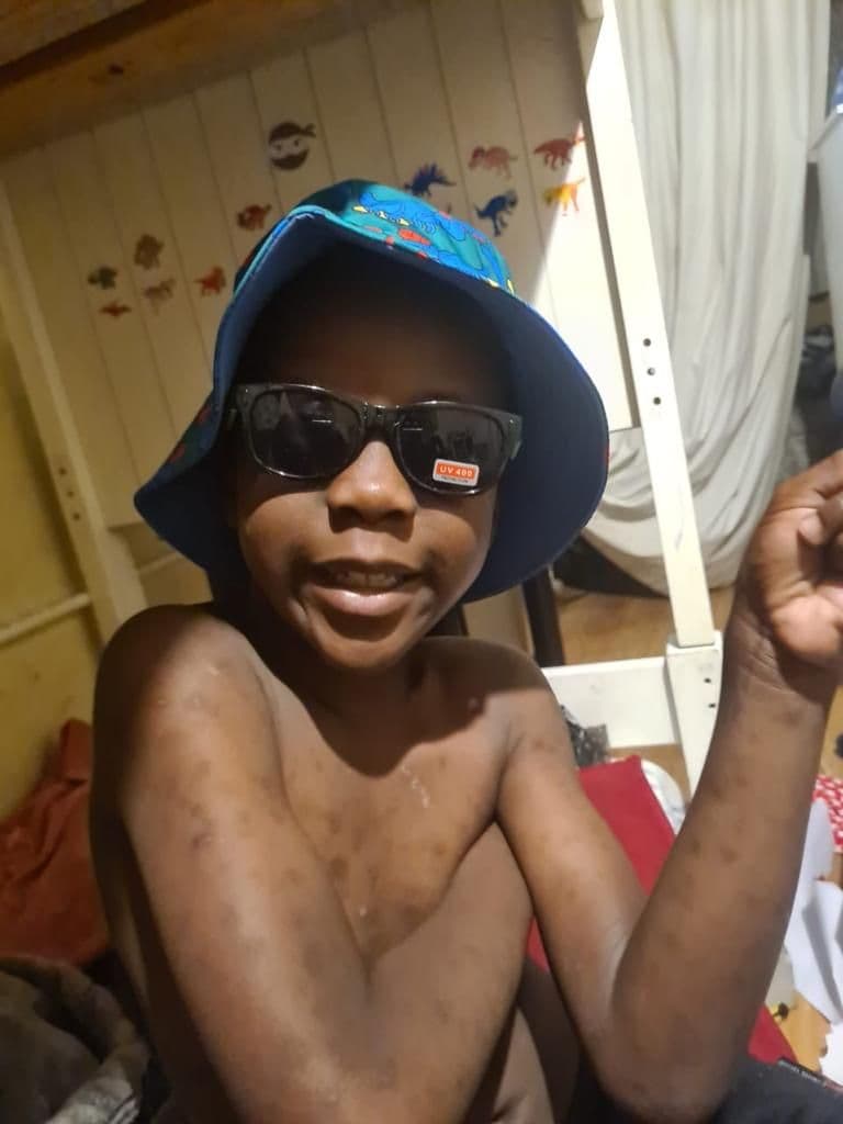 The sunnies and hat were a hit for Timo